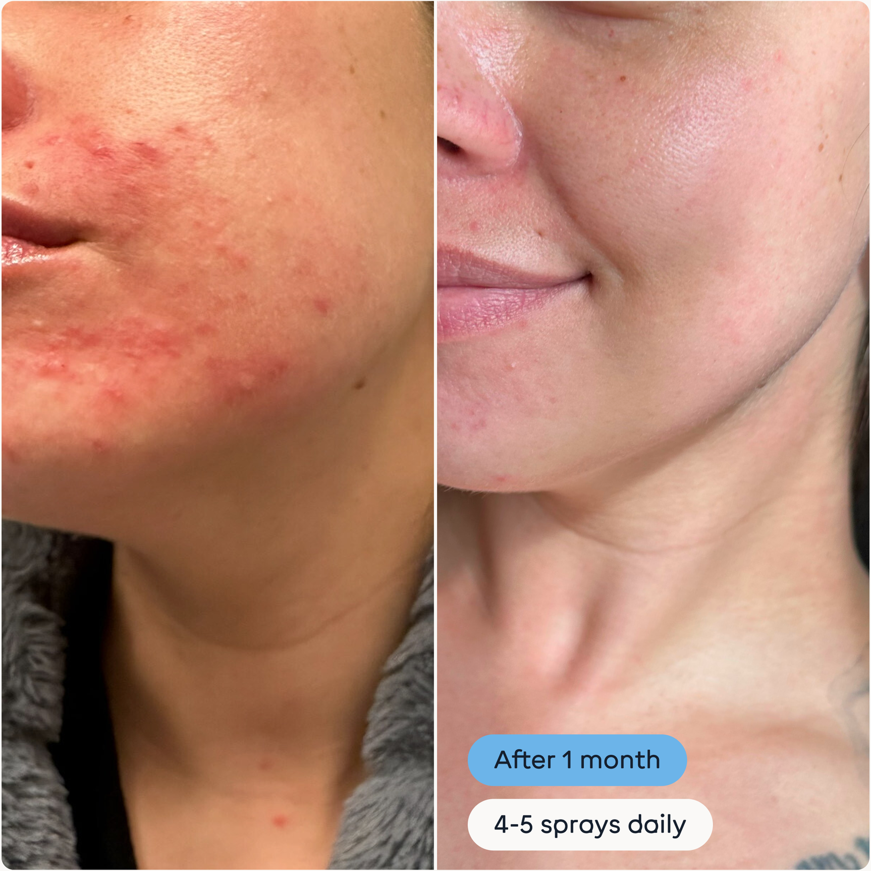 The Solution W/S: Standard