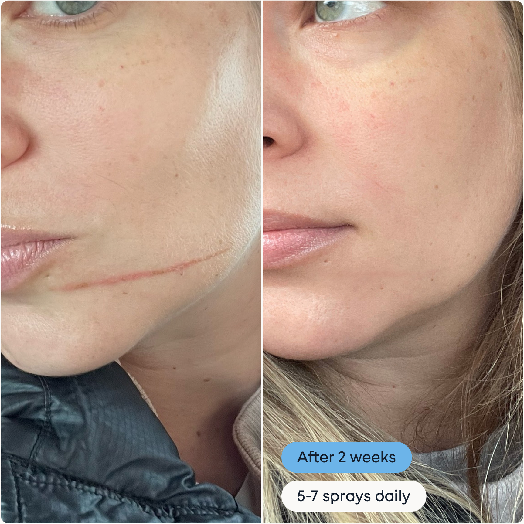 The Solution W/S: Standard