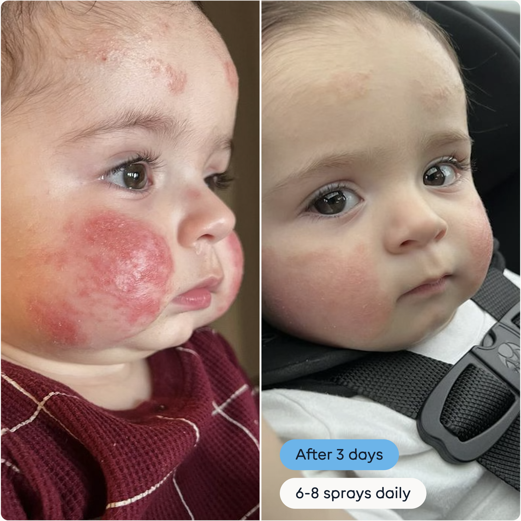 The Solution W/S: Standard