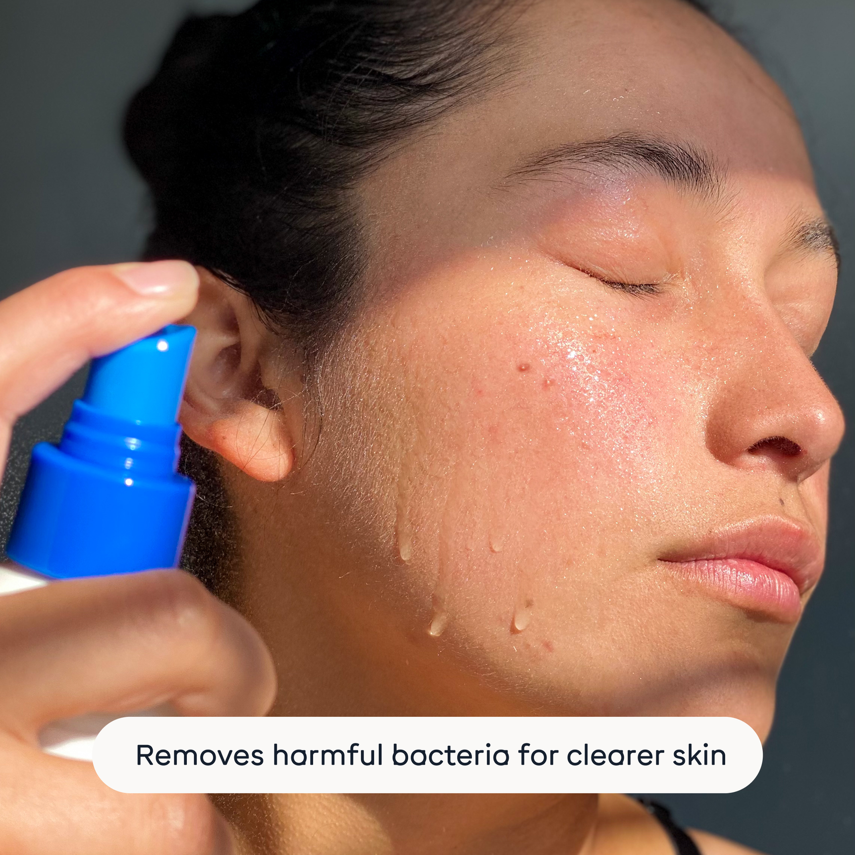 The Solution W/S: Standard